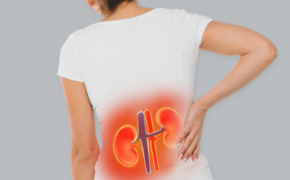 콩팥질환 이미지